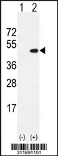 Western blot analysis of his-tag ATG3 (arrow) using his tag antibody. 293 cell lysates (2 ug/lane) either nontransfected (Lane 1) or transiently transfected with the ATG3 gene