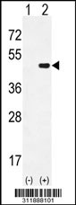 Western blot analysis of his-tag APOBEC3G (arrow) using his tag antibody. 293 cell lysates (2 ug/lane) either nontransfected (Lane 1) or transiently transfected with the APOBEC3G gene