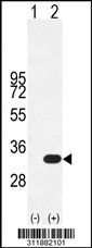 Western blot analysis of his-tag ORC6L (arrow) using his tag antibody. 293 cell lysates (2 ug/lane) either nontransfected (Lane 1) or transiently transfected with the ORC6L gene
