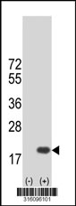 Western blot analysis of his-tag FAM36A (arrow) using his tag antibody. 293T cell lysates (2 ug/lane) either nontransfected (Lane 1) or transiently transfected with the FAM36A gene‘