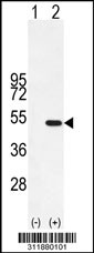 Western blot analysis of his-tag HDAC8 (arrow) using his tag antibody. 293 cell lysates (2 ug/lane) either nontransfected (Lane 1) or transiently transfected with the HDAC8 gene