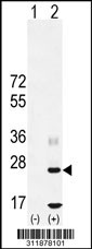 Western blot analysis of his-tag CLRN3 (arrow) using his tag antibody. 293 cell lysates (2 ug/lane) either nontransfected (Lane 1) or transiently transfected with the CLRN3 gene