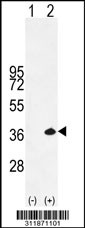Western blot analysis of his-tag TWF1 (arrow) using his tag antibody. 293 cell lysates (2 ug/lane) either nontransfected (Lane 1) or transiently transfected with the TWF1 gene