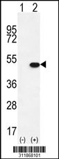 Western blot analysis of his-tag PRPH (arrow) using his tag antibody. 293 cell lysates (2 ug/lane) either nontransfected (Lane 1) or transiently transfected with the PRPH gene