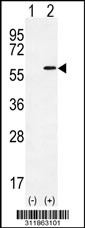 Western blot analysis of his-tag SENP2 (arrow) using his tag antibody. 293 cell lysates (2 ug/lane) either nontransfected (Lane 1) or transiently transfected with the SENP2 gene