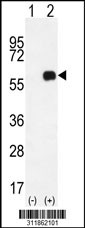 Western blot analysis of his-tag PRPH (arrow) using his tag antibody. 293 cell lysates (2 ug/lane) either nontransfected (Lane 1) or transiently transfected with the PRPH gene
