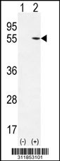 Western blot analysis of his-tag MFAP1 (arrow) using his tag antibody. 293 cell lysates (2 ug/lane) either nontransfected (Lane 1) or transiently transfected with the MFAP1 gene