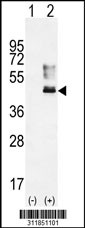 Western blot analysis of his-tag PRPH (arrow) using his tag antibody. 293 cell lysates (2 ug/lane) either nontransfected (Lane 1) or transiently transfected with the PRPH gene