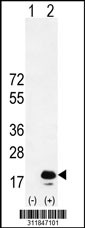 Western blot analysis of his-tag PRPH (arrow) using his tag antibody. 293 cell lysates (2 ug/lane) either nontransfected (Lane 1) or transiently transfected with the PRPH gene
