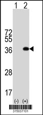 Western blot analysis of his-tag C17orf63 (arrow) using his tag antibody. 293T cell lysates (2 ug/lane) either nontransfected (Lane 1) or transiently transfected with the C17orf63 gene‘