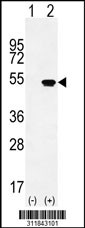 Western blot analysis of his-tag PRPH (arrow) using his tag antibody. 293 cell lysates (2 ug/lane) either nontransfected (Lane 1) or transiently transfected with the PRPH gene