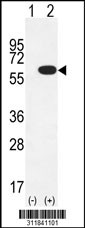 Western blot analysis of his-tag PRPH (arrow) using his tag antibody. 293 cell lysates (2 ug/lane) either nontransfected (Lane 1) or transiently transfected with the PRPH gene