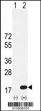 Western blot analysis of his-tag CDA (arrow) using his tag antibody. 293 cell lysates (2 ug/lane) either nontransfected (Lane 1) or transiently transfected with the CDA gene