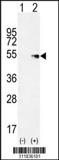 Western blot analysis of his-tag PRPH (arrow) using his tag antibody. 293 cell lysates (2 ug/lane) either nontransfected (Lane 1) or transiently transfected with the PRPH gene