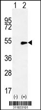 Western blot analysis of his-tag PRPH (arrow) using his tag antibody. 293 cell lysates (2 ug/lane) either nontransfected (Lane 1) or transiently transfected with the PRPH gene