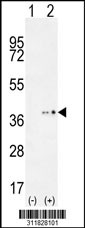 Western blot analysis of his-tag PRPH (arrow) using his tag antibody. 293 cell lysates (2 ug/lane) either nontransfected (Lane 1) or transiently transfected with the PRPH gene
