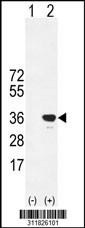 Western blot analysis of his-tag PRPH (arrow) using his tag antibody. 293 cell lysates (2 ug/lane) either nontransfected (Lane 1) or transiently transfected with the PRPH gene