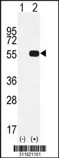 Western blot analysis of his-tag PRPH (arrow) using his tag antibody. 293 cell lysates (2 ug/lane) either nontransfected (Lane 1) or transiently transfected with the PRPH gene