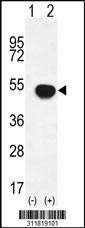 Western blot analysis of his-tag PRPH (arrow) using his tag antibody. 293 cell lysates (2 ug/lane) either nontransfected (Lane 1) or transiently transfected with the PRPH gene