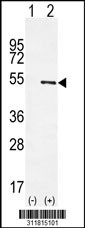 Western blot analysis of his-tag PRPH (arrow) using his tag antibody. 293 cell lysates (2 ug/lane) either nontransfected (Lane 1) or transiently transfected with the PRPH gene