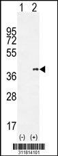 Western blot analysis of his-tag PRPH (arrow) using his tag antibody. 293 cell lysates (2 ug/lane) either nontransfected (Lane 1) or transiently transfected with the PRPH gene