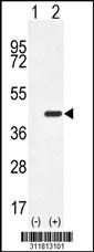 Western blot analysis of his-tag PRPH (arrow) using his tag antibody. 293 cell lysates (2 ug/lane) either nontransfected (Lane 1) or transiently transfected with the PRPH gene