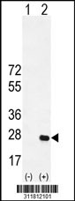 Western blot analysis of his-tag PRPH (arrow) using his tag antibody. 293 cell lysates (2 ug/lane) either nontransfected (Lane 1) or transiently transfected with the PRPH gene