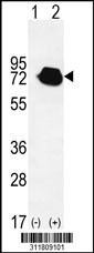 Western blot analysis of his-tag NRP1 (arrow) using his tag antibody. 293 cell lysates (2 ug/lane) either nontransfected (Lane 1) or transiently transfected with the NRP1 gene