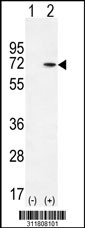 Western blot analysis of his-tag MEF2D (arrow) using his tag antibody. 293 cell lysates (2 ug/lane) either nontransfected (Lane 1) or transiently transfected with the MEF2D gene