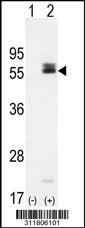 Western blot analysis of his-tag IL6R (arrow) using his tag antibody. 293 cell lysates (2 ug/lane) either nontransfected (Lane 1) or transiently transfected with the IL6R gene