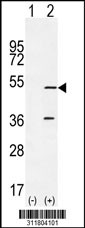 Western blot analysis of his-tag HELLS (arrow) using his tag antibody. 293 cell lysates (2 ug/lane) either nontransfected (Lane 1) or transiently transfected with the HELLS gene