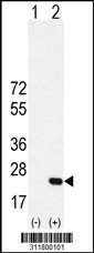 Western blot analysis of his-tag PRPH (arrow) using his tag antibody. 293 cell lysates (2 ug/lane) either nontransfected (Lane 1) or transiently transfected with the PRPH gene