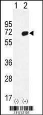 Western blot analysis of his-tag PLAT (arrow) using his tag antibody. 293 cell lysates (2 ug/lane) either nontransfected (Lane 1) or transiently transfected with the PLAT gene