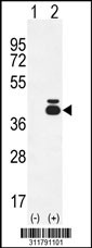 Western blot analysis of his-tag PDHB (arrow) using his tag antibody. 293 cell lysates (2 ug/lane) either nontransfected (Lane 1) or transiently transfected with the PDHB gene