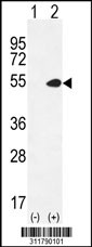 Western blot analysis of his-tag NFKBIA (arrow) using his tag antibody. 293 cell lysates (2 ug/lane) either nontransfected (Lane 1) or transiently transfected with the NFKBIA gene