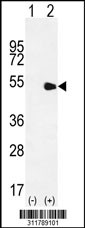 Western blot analysis of his-tag NEUROD1 (arrow) using his tag antibody. 293 cell lysates (2 ug/lane) either nontransfected (Lane 1) or transiently transfected with the NEUROD1 gene