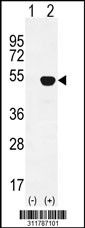 Western blot analysis of his-tag GNAS (arrow) using his tag antibody. 293 cell lysates (2 ug/lane) either nontransfected (Lane 1) or transiently transfected with the GNAS gene