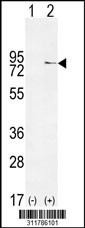Western blot analysis of his-tag EYA1 (arrow) using his tag antibody. 293 cell lysates (2 ug/lane) either nontransfected (Lane 1) or transiently transfected with the EYA1 gene