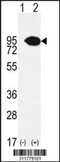 Western blot analysis of his-tag CLGN (arrow) using his tag antibody. 293 cell lysates (2 ug/lane) either nontransfected (Lane 1) or transiently transfected with the CLGN gene
