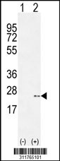 Western blot analysis of his-tag RAC1 (arrow) using his tag antibody. 293 cell lysates (2 ug/lane) either nontransfected (Lane 1) or transiently transfected with the RAC1 gene