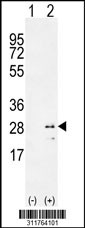 Western blot analysis of his-tag PTHLH (arrow) using his tag antibody. 293 cell lysates (2 ug/lane) either nontransfected (Lane 1) or transiently transfected with the PTHLH gene