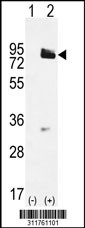 Western blot analysis of his-tag NTRK3 (arrow) using his tag antibody. 293 cell lysates (2 ug/lane) either nontransfected (Lane 1) or transiently transfected with the NTRK3 gene