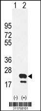 Western blot analysis of his-tag LY86 (arrow) using his tag antibody. 293 cell lysates (2 ug/lane) either nontransfected (Lane 1) or transiently transfected with the LY86 gene