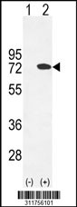 Western blot analysis of his-tag LCP2 (arrow) using his tag antibody. 293 cell lysates (2 ug/lane) either nontransfected (Lane 1) or transiently transfected with the LCP2 gene