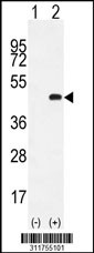 Western blot analysis of his-tag FBXO4 (arrow) using his tag antibody. 293 cell lysates (2 ug/lane) either nontransfected (Lane 1) or transiently transfected with the FBXO4 gene