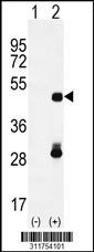 Western blot analysis of his-tag FAM70A (arrow) using his tag antibody. 293 cell lysates (2 ug/lane) either nontransfected (Lane 1) or transiently transfected with the FAM70A gene