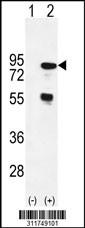 Western blot analysis of his-tag CTTN (arrow) using his tag antibody. 293 cell lysates (2 ug/lane) either nontransfected (Lane 1) or transiently transfected with the CTTN gene