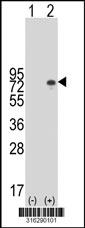 Western blot analysis of his-tag PTK2 (arrow) using his tag antibody. 293T cell lysates (2 ug/lane) either nontransfected (Lane 1) or transiently transfected with the PTK2 gene‘