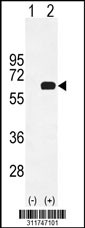 Western blot analysis of his-tag CPE (arrow) using his tag antibody. 293 cell lysates (2 ug/lane) either nontransfected (Lane 1) or transiently transfected with the CPE gene