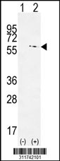 Western blot analysis of his-tag AIFM3 (arrow) using his tag antibody. 293 cell lysates (2 ug/lane) either nontransfected (Lane 1) or transiently transfected with the AIFM3 gene